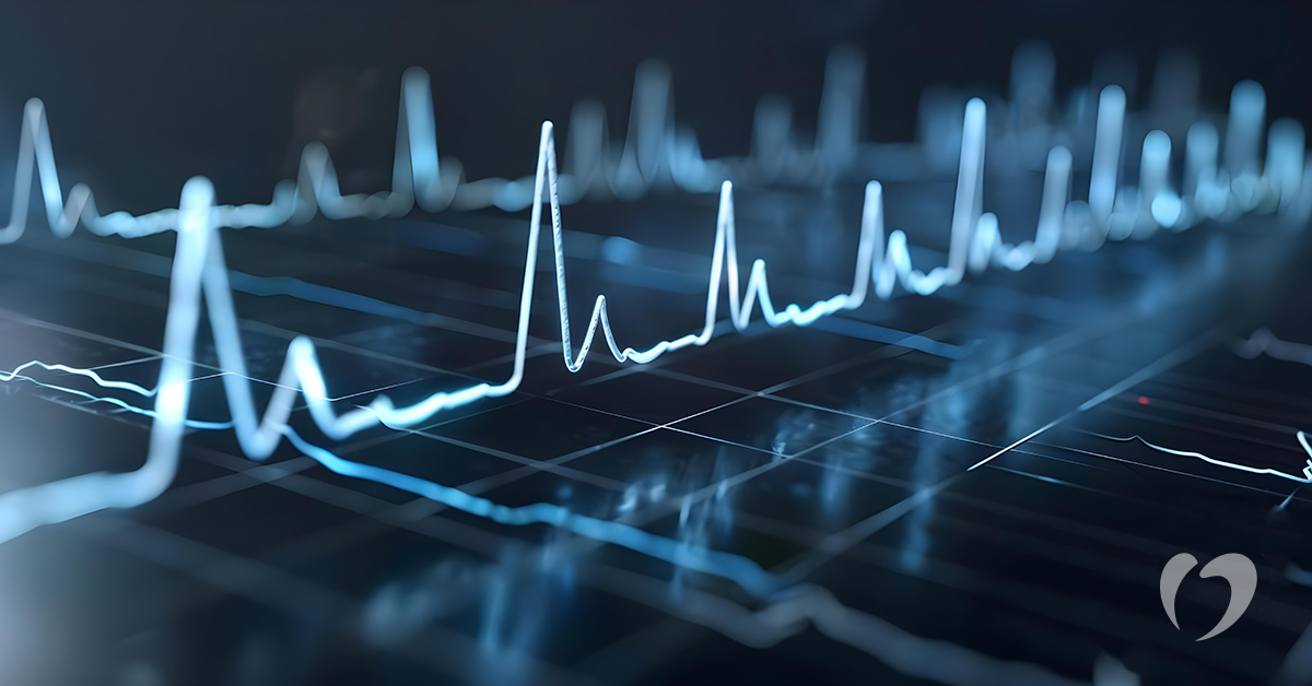 A close-up view of an electrocardiogram (ECG) display showing multiple heart rhythm waveforms on a dark background.