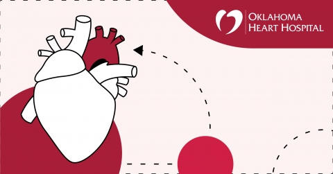 Aortic Aneurysm