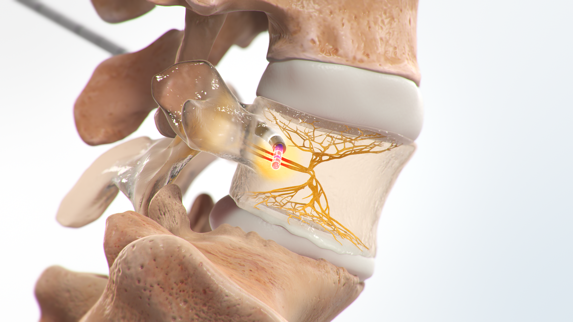Interventional Pain Management Center - Oklahoma Heart Hospital